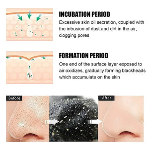 edistore, edistore.us, Black Dot Face Mask T-zone Cleaning Women Men Bamboo Charcoal Blackhead Facial Masks Skin Care