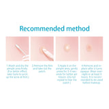 edistore, edistore.us, LANBENA Acne Pimple Patch Stickers Acne Treatment Pimple Remover Tool 