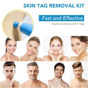 edistore, edistore.us,2 In1 Painless Auto Skin Tag Mole Wart Removal Kit Cleaning Tools Face Skin Care