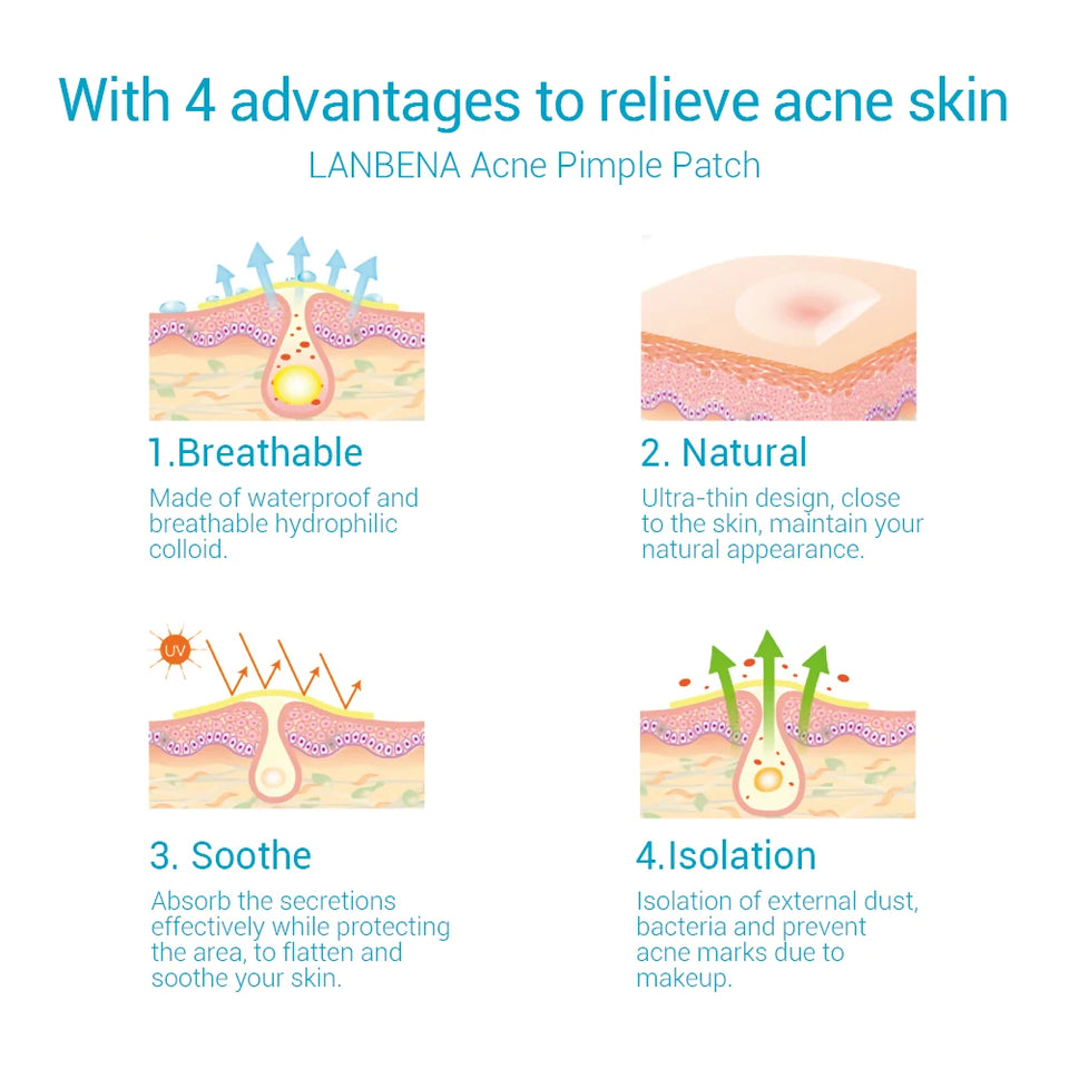 edistore, edistore.us, LANBENA Acne Pimple Patch Stickers Acne Treatment Pimple Remover Tool 